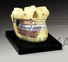 Teeth Upper & Lower Jaw Professional Model